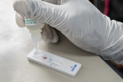 Close-up of hand with a dropper bottle and plastic test strip